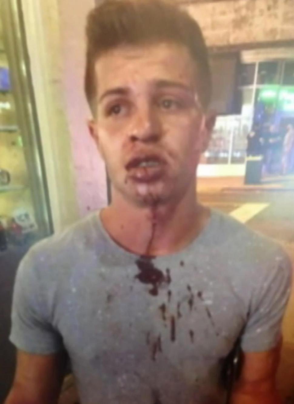 Miami: Ragazzo picchiato perché gay. Video shock dell'aggressione - aggressione omofoba miami 2016 3 - Gay.it