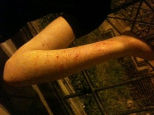 Banda di giovani aggredisce un uomo che aveva difeso due gay - aggressione villa pamphiliF1 - Gay.it