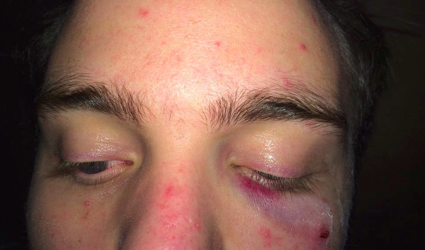 Stefano, il ragazzo aggredito a Torino