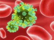 In provincia di Venezia c'è la "tassa" sull'HIV - aidsnuovoBASE - Gay.it