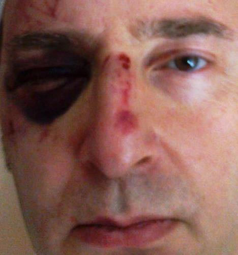Roma, aggredito un altro giovane gay. Grillini: "Ora basta" - allegrezza aggressioneF4 - Gay.it