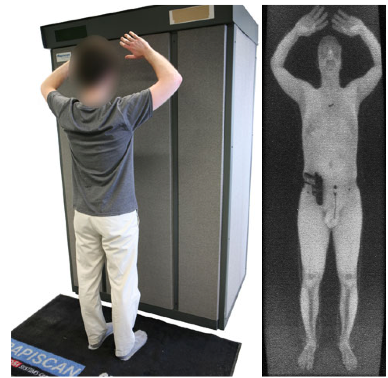 Transgender ha dovuto rimuovere protesi pene per passare il body scan - body scan - Gay.it