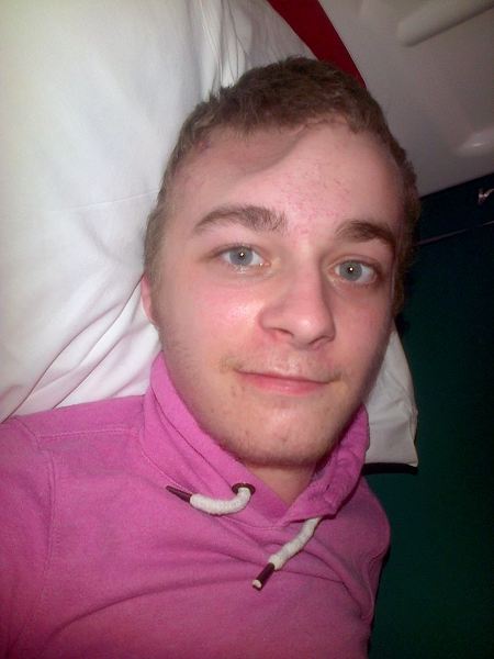 Preso a martellate in testa perché gay: Connor salvo per miracolo - connor aggressione kent3 - Gay.it