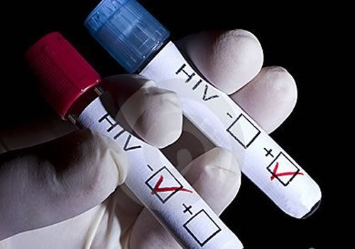 AIDS: importante scoperta di un team di scienziati italiani - diario hiv1 - Gay.it