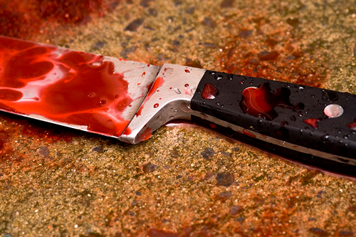 Si taglia il pene con un coltello perché "colpevole" del suo male - evirazione livorno1 - Gay.it