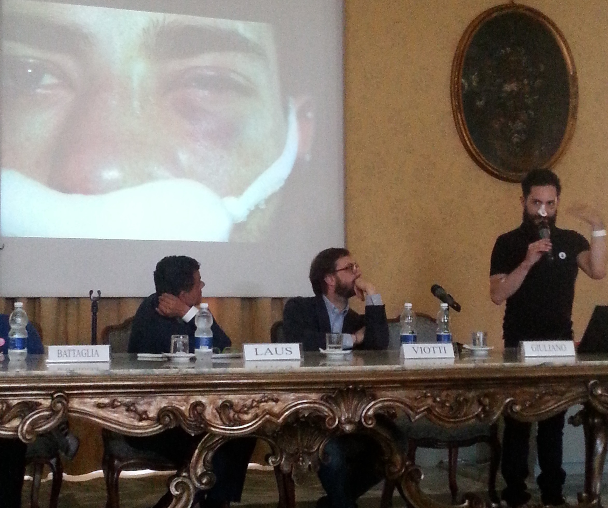 Torino accoglie Andrea Giuliano, l'attivista aggredito a Budapest - giuli4conf - Gay.it