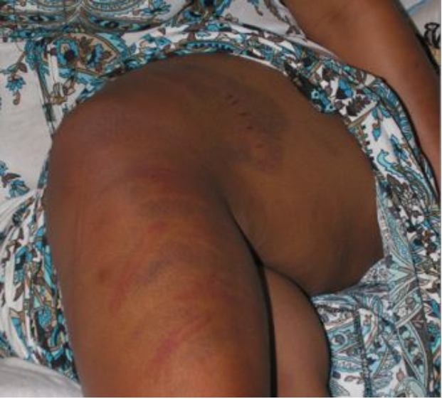 Kenya: sospese da scuola e picchiate per "lesbismo" - kenya picchiate1 - Gay.it