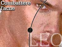 COMBATTERE L'ACNE - estetica acne - Gay.it
