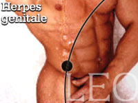 HERPES GENITALE