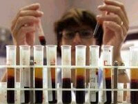 Aids, arriva il vaccino almeno per i gatti