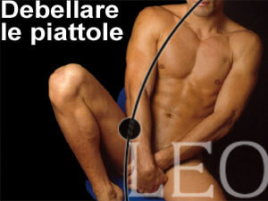 DEBELLARE LE PIATTOLE