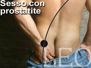 SESSO CON PROSTATITE