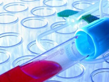 Tre anni di inferno per una diagnosi di Aids sbagliata