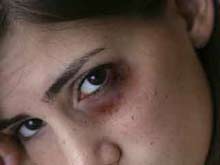 Fiaccolata di solidarietà per la ragazza aggredita a Napoli - occhionero2BASE - Gay.it
