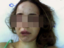 Calci e pugni: aggredita una trans a Firenze