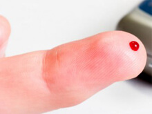 HIV, test rapido approvato in USA. Risultati in 60 secondi