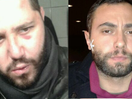 Aggredita coppia a Firenze. Si stavano baciando per strada