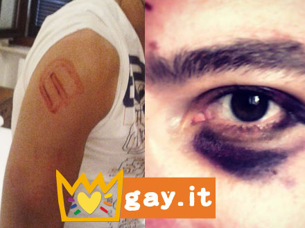 Botte e cinghiate, aggrediti quattro ragazzi gay a Torino