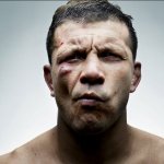 Le facce rotte dei rugbisti fotografate da Denis Rouvre - Thumbnail