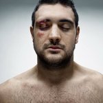Le facce rotte dei rugbisti fotografate da Denis Rouvre - Thumbnail