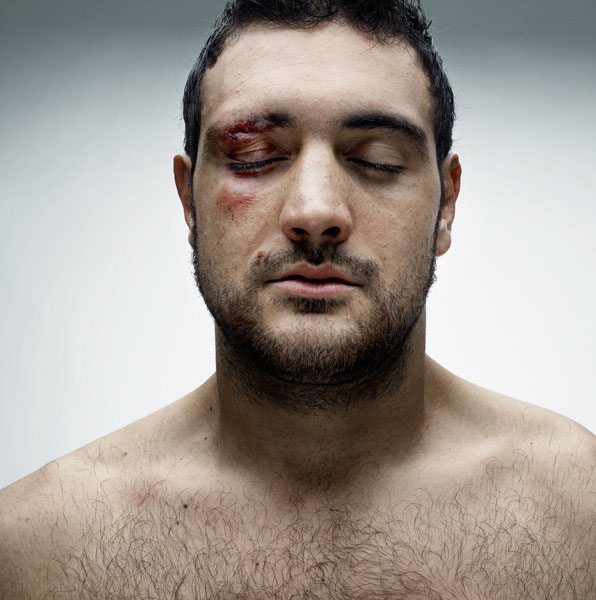 Le facce rotte dei rugbisti fotografate da Denis Rouvre
