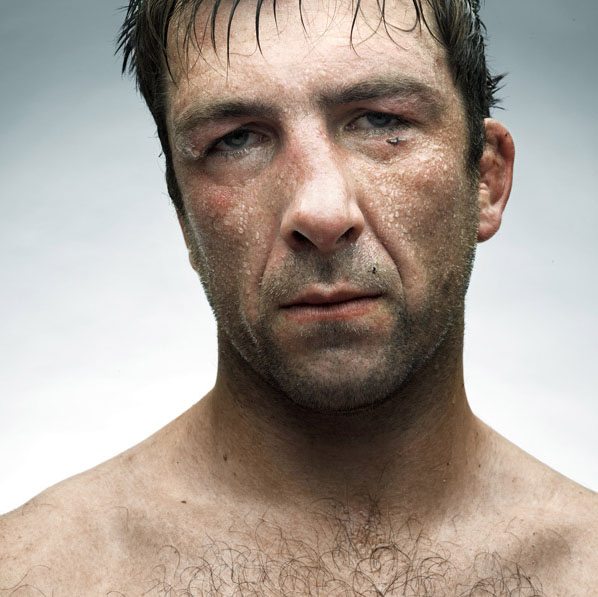 Le facce rotte dei rugbisti fotografate da Denis Rouvre