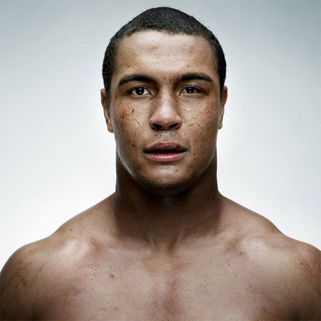 Le facce rotte dei rugbisti fotografate da Denis Rouvre