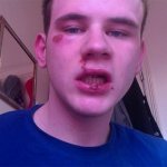 aggressione uk - Thumbnail