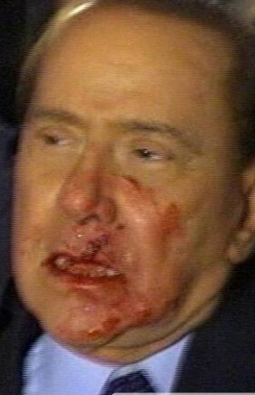 Foto del giorno di Lunedì 14 Dicembre 2009 - 15542 berlusconisangue1 - Gay.it