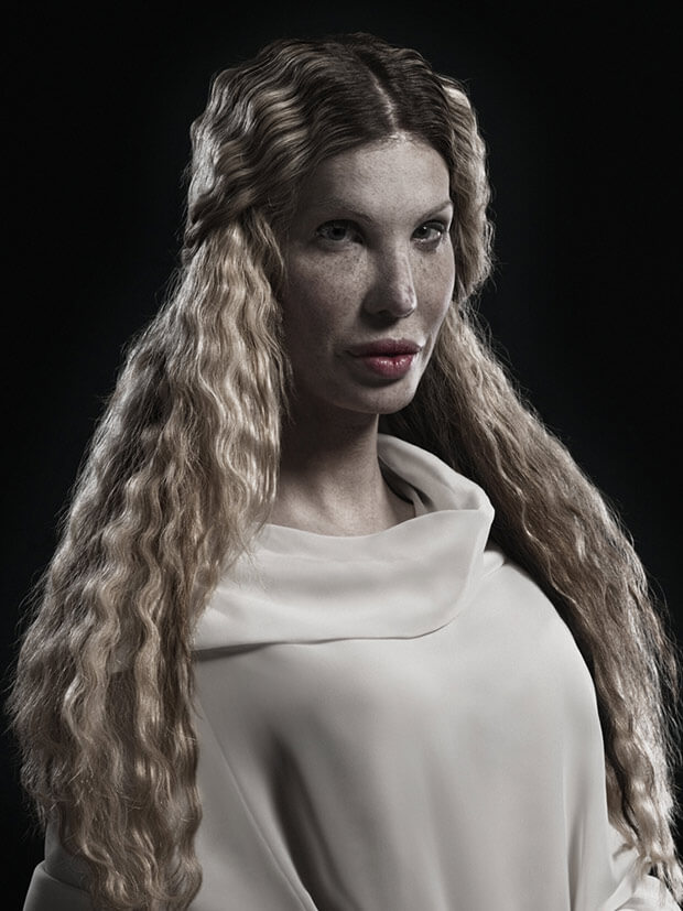 A New Kind Of Beauty: quando la chirurgia estetica c'è (e si vede)