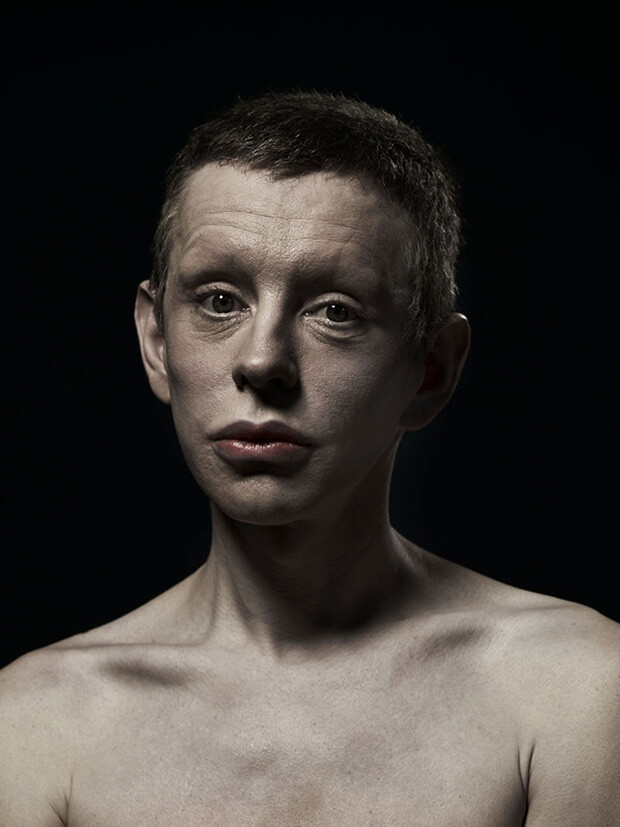 A New Kind Of Beauty: quando la chirurgia estetica c'è (e si vede)