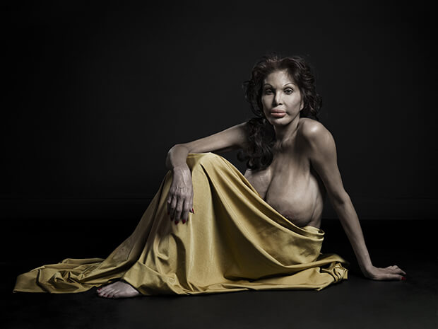 A New Kind Of Beauty: quando la chirurgia estetica c'è (e si vede)