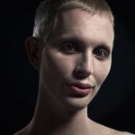 A New Kind Of Beauty: quando la chirurgia estetica c'è (e si vede) - Thumbnail