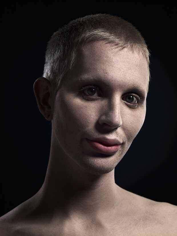 A New Kind Of Beauty: quando la chirurgia estetica c'è (e si vede)