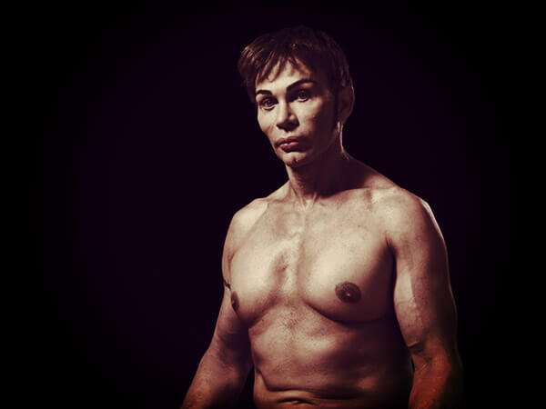 A New Kind Of Beauty: quando la chirurgia estetica c'è (e si vede) - Phillip Toledano rifatti chirurgia estetica BS - Gay.it
