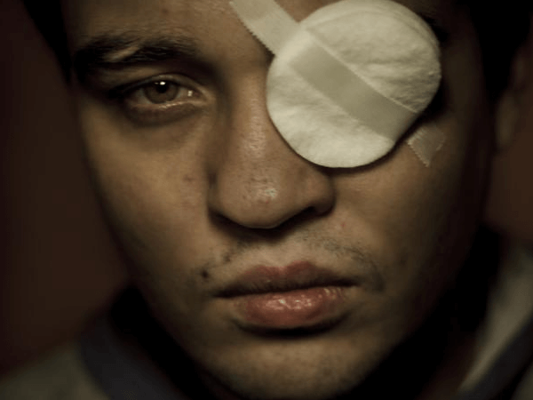 homophobia: il reportage sull'odio contro i gay e le lesbiche in Russia