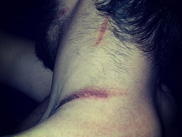 Roma, omosessuale aggredito durante una serata gay: “Frocio di merda”