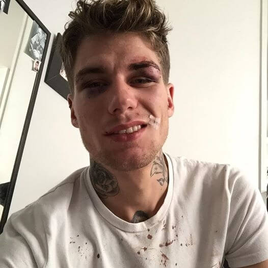 Clément Grobotek_gay_picchiato