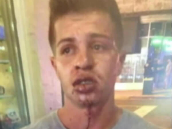 Miami: Ragazzo picchiato perché gay. Video shock dell'aggressione - aggressione omofoba miami 2016 4 - Gay.it