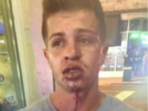 Miami: Ragazzo picchiato perché gay. Video shock dell’aggressione