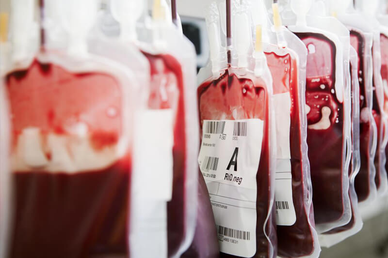 Gli Stati Uniti vogliono togliere il divieto sulla donazione di sangue per uomini gay