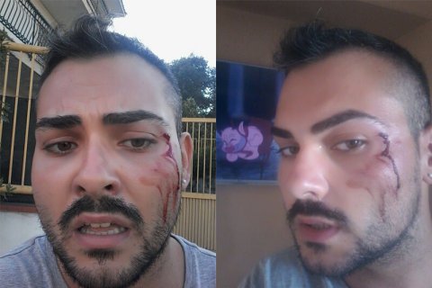 Aggressione omofoba a Napoli: ragazzo gay preso a calci e pugni - napoli omofobia - Gay.it