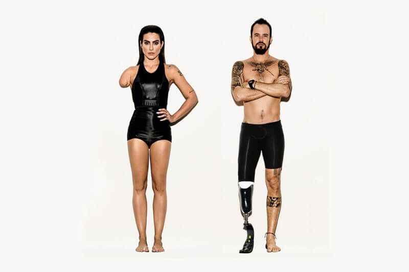 Paralimpiadi: Vogue Brasile modifica le foto dei modelli e li rende disabili. Giusto o sbagliato? - vogue brazil paralympics - Gay.it