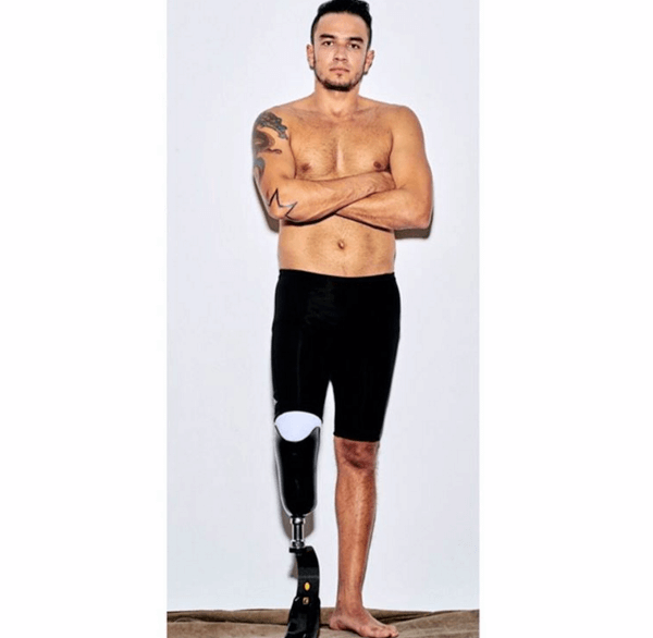 Paralimpiadi: Vogue Brasile modifica le foto dei modelli e li rende disabili. Giusto o sbagliato?