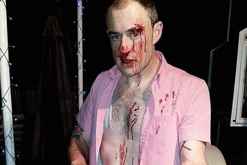 Omofobia in Nuova Zelanda: violenta aggressione con calci e pugni solo per una camicia rosa - pink shirt - Gay.it