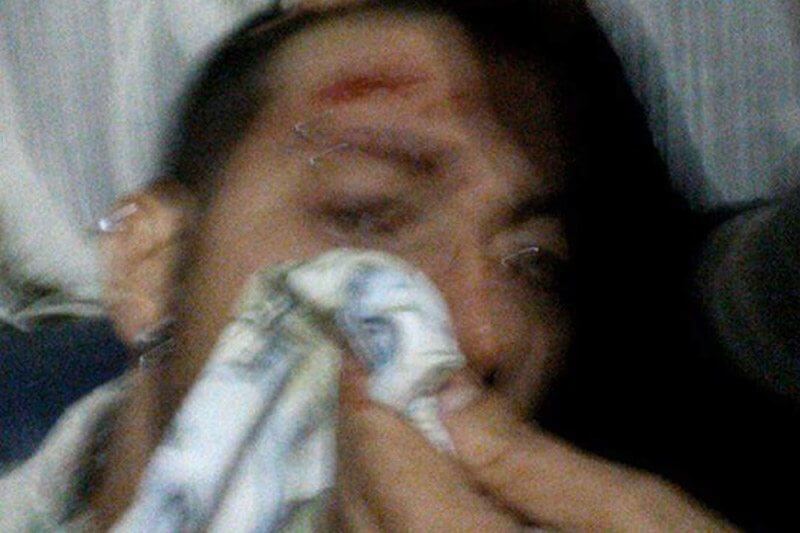 Salerno, ragazzo massacrato per una maglia con scritto ‘Io gay’: “I ricchioni devono morire”