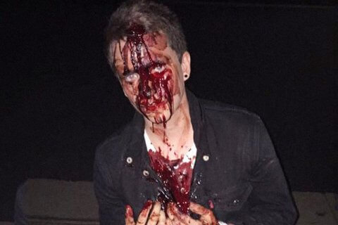 Ragazzo gay pestato a sangue dai sostenitori di Donald Trump subito dopo l'elezione - aggressione omofoba gay - Gay.it