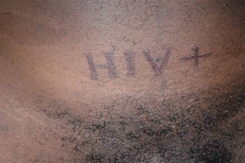 Faresti sesso con un partner che ti ha confessato di essere HIV+? SONDAGGIO