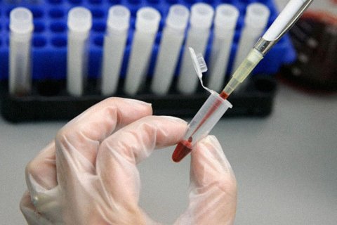 HIV: ogni quanto fai il test? Rispondi al sondaggio! - test hiv - Gay.it