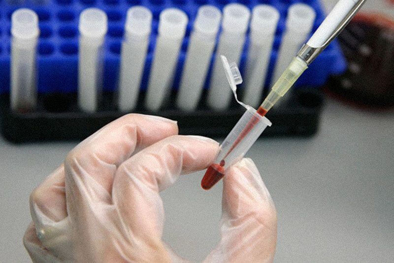 HIV: ogni quanto fai il test? Rispondi al sondaggio!